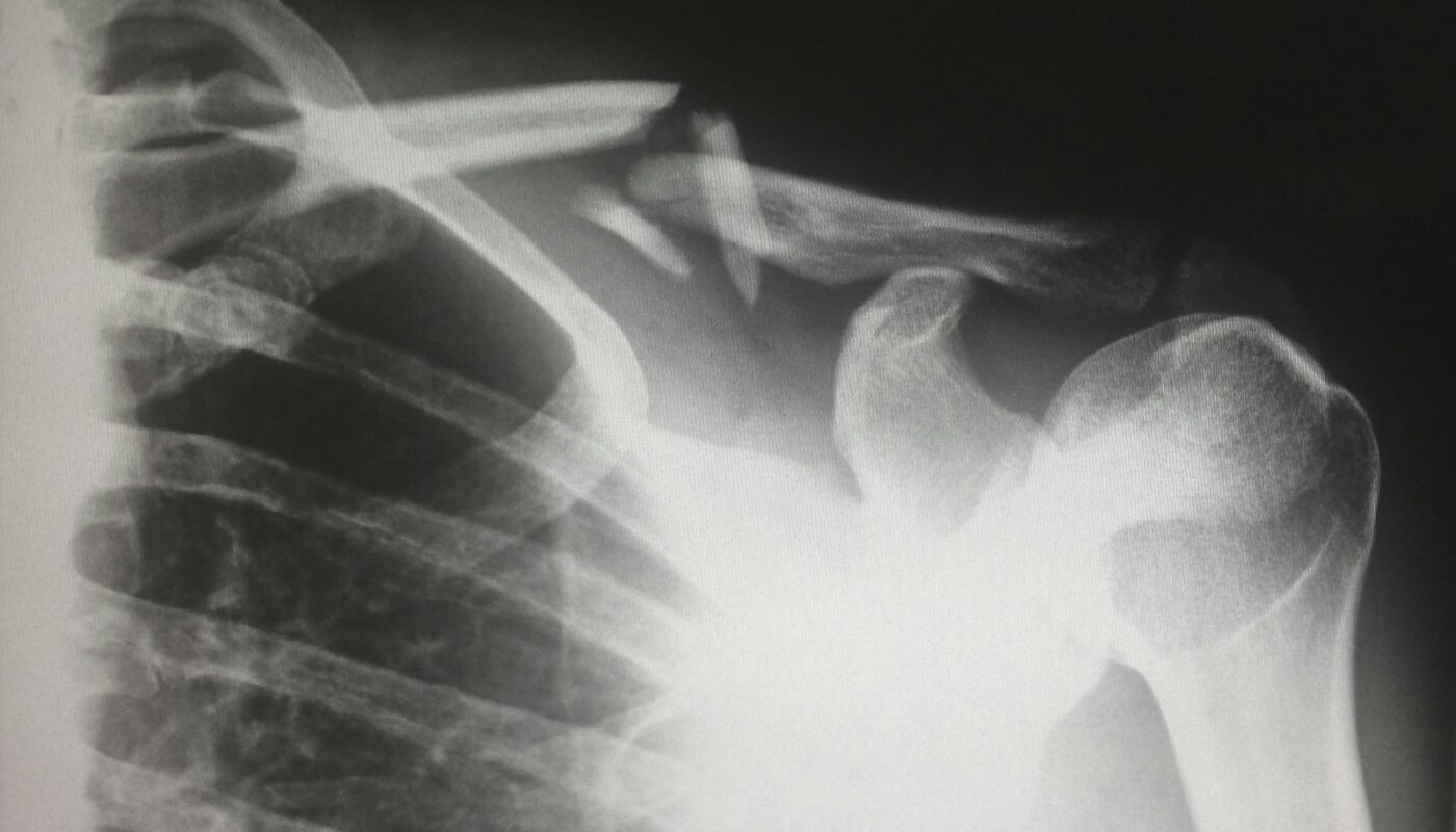 human X-ray result chart